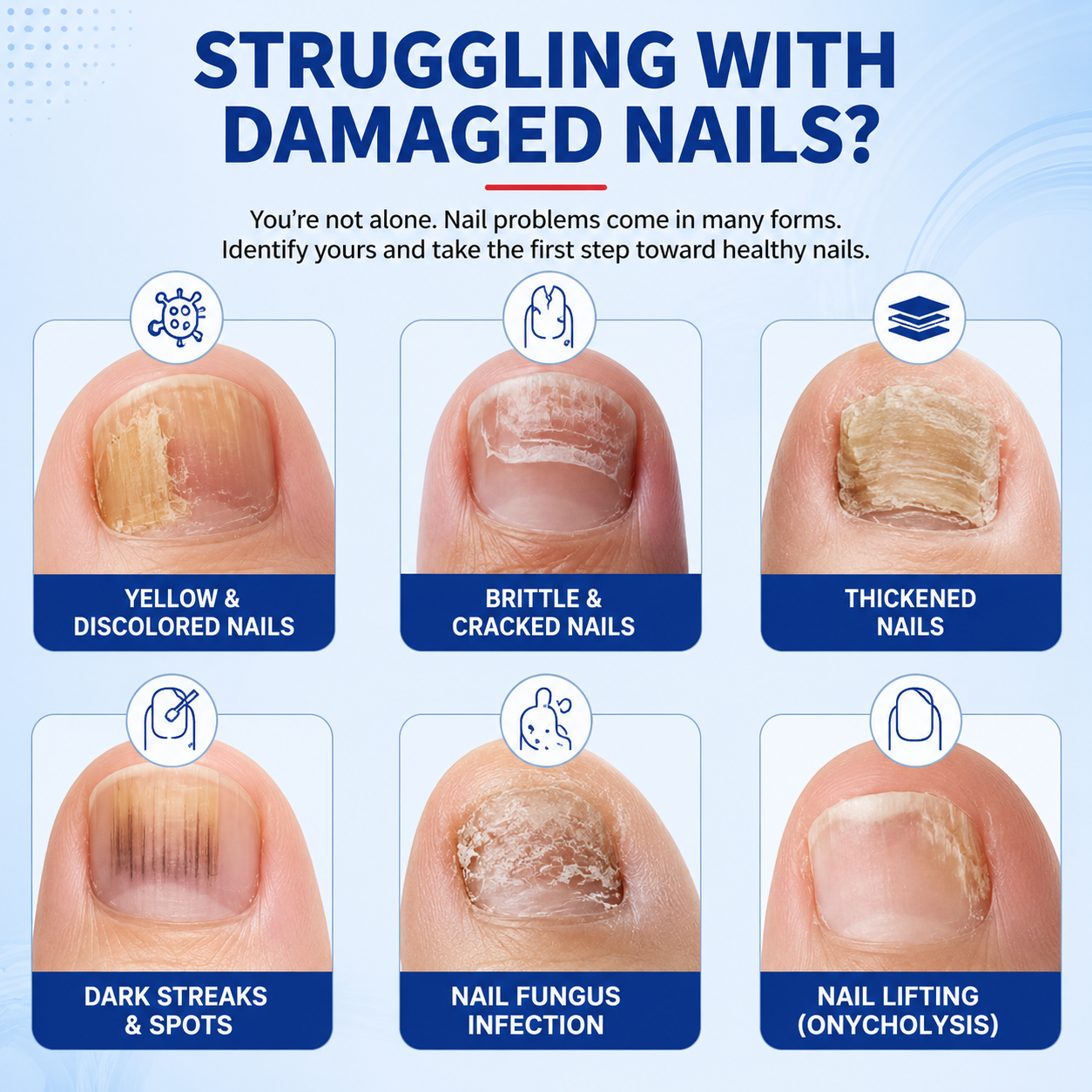 Cliora™ Fungal Nail Repair Patches