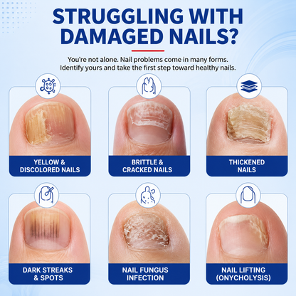 Cliora™ Fungal Nail Repair Patches