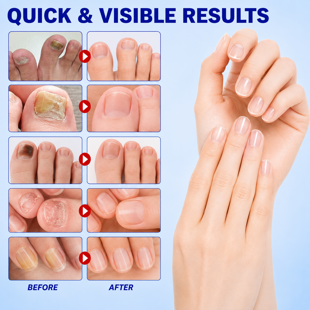 Cliora™ Fungal Nail Repair Patches